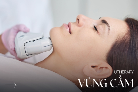 Utherapy vùng cằm